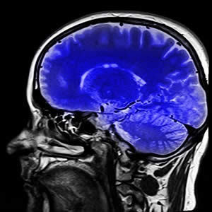 New Method for Automating 3D-MRI Quality Assessment New Method for Automating 3D-MRI Quality Assessment