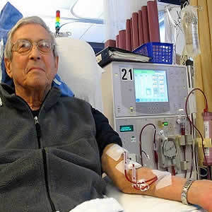 Peritoneal Dialysis: Evidence, Guidelines, and Controversies Peritoneal Dialysis: Evidence, Guidelines, and Controversies