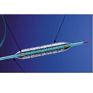 Radial Access, Same-Day PCI Could Save $300 Million Annually Radial Access, Same-Day PCI Could Save $300 Million Annually