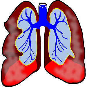 The Imaging of Small Pulmonary Nodules The Imaging of Small Pulmonary Nodules