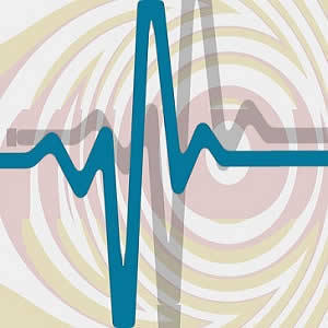 Azithromycin Not Linked to Increased Arrhythmia Risk Azithromycin Not Linked to Increased Arrhythmia Risk