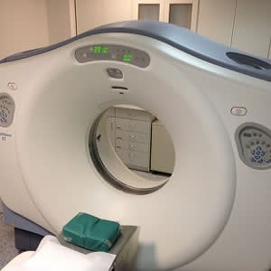 Right colonic diverticulitis: CT predictors of poor outcomes Right colonic diverticulitis: CT predictors of poor outcomes