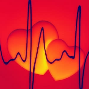 Depression increases risk for atrial fibrillation Depression increases risk for atrial fibrillation