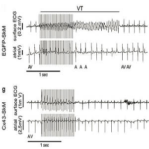 Burst stimulation induces self-terminating VT in a representative EGFP-SkM transplanted mouse in vivo. Burst stimulation induces self-terminating VT in a representative EGFP-SkM transplanted mouse in vivo.