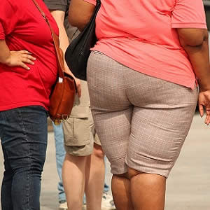 Obesity kills: doctors call for better training for effective care Obesity kills: doctors call for better training for effective care