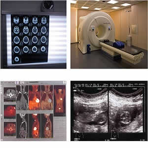 Mitigating radiation risk in medical imaging: expert opinion Mitigating radiation risk in medical imaging: expert opinion