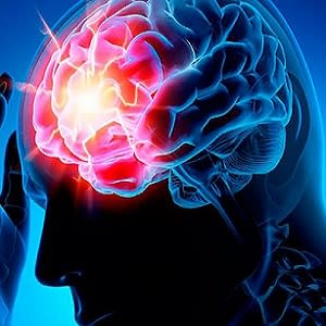 CAC + carotid artery intima-media thickness for better stroke prediction CAC + carotid artery intima-media thickness for better stroke prediction
