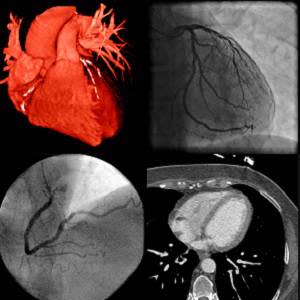 Cardiologists and radiologists need to work together – IDoR 2018 Cardiologists and radiologists need to work together – IDoR 2018
