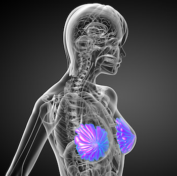 AI-radiomics mammography combo reduces breast biopsies AI-radiomics mammography combo reduces breast biopsies