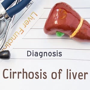 Acute-on-chronic liver failure: criteria for ICU admission Acute-on-chronic liver failure: criteria for ICU admission