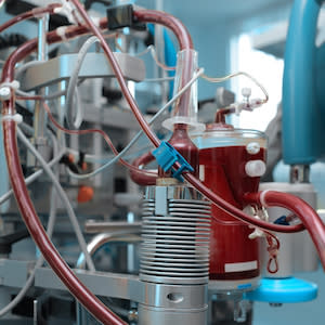 Weaning from extracorporeal systems in patients with severe COPD Weaning from extracorporeal systems in patients with severe COPD