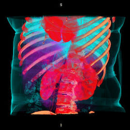 Outside the box: imaging quantum leap 'sees' deeper into live organs Outside the box: imaging quantum leap 'sees' deeper into live organs