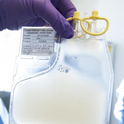 Radiation Lowers Side Effects of CAR T Therapy in Non-Hodgkin's Lymphoma Radiation Lowers Side Effects of CAR T Therapy in Non-Hodgkin's Lymphoma