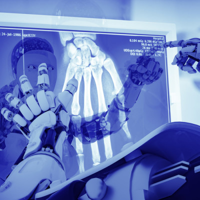 AI Accuracy Matches Clinicians' AI Accuracy Matches Clinicians'