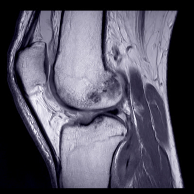 Focus on Sports Imaging for International Day of Radiology Focus on Sports Imaging for International Day of Radiology