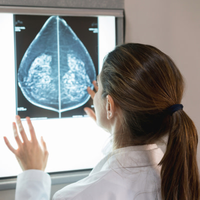 Tackling Urgent Breast Radiologist Shortage Tackling Urgent Breast Radiologist Shortage