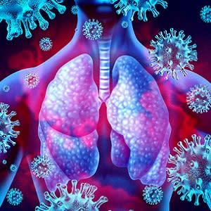 Pulmonary Pathobiology of COVID-19 Pulmonary Pathobiology of COVID-19
