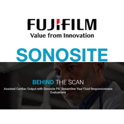 Assisted Cardiac Output with Sonosite PX: Streamline Your Fluid Responsiveness Evaluations Assisted Cardiac Output with Sonosite PX: Streamline Your Fluid Responsiveness Evaluations