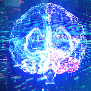 Dynamic Brain Imaging With AI Dynamic Brain Imaging With AI