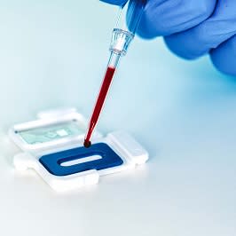 Abionic Webinar - Advancing the Diagnosis of Sepsis in the ...