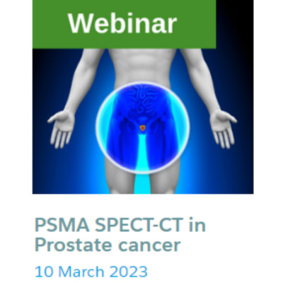 PSMA SPECT-CT in Prostate cancer PSMA SPECT-CT in Prostate cancer