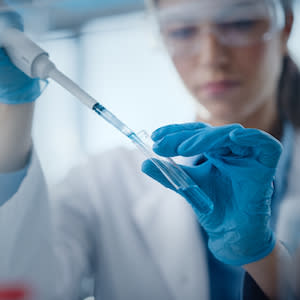 Nanofluidic Technology Enables Rapid Quantification of PSP as an Early Biomarker of Sepsis Nanofluidic Technology Enables Rapid Quantification of PSP as an Early Biomarker of Sepsis