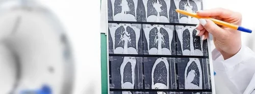 Radiologist showing tomography scan of a patient's lungs over of CT machine.