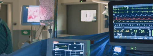 Principles to Guide Intraoperative Mechanical Ventilation