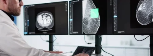 Radiologist reviewing mammography images on multiple monitors, representing breast imaging analysis and computer-assisted diagnosis.