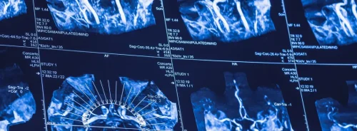 Multiple vascular imaging scans displayed on a workstation, illustrating advanced neuroimaging analysis, visualisation of cerebral vessels and diagnostic assessment in radiology.