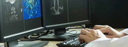Neurovascular imaging review, supporting angiography assessment, stroke evaluation, radiology reporting and treatment planning.