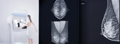 Mammography screening concept, supporting breast imaging review, cancer detection, women’s health diagnostics and radiology reporting