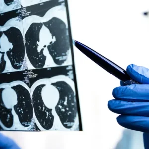 Clinician reviewing chest CT scans, supporting lung imaging, diagnostic assessment, respiratory care and clinical decision-making.
