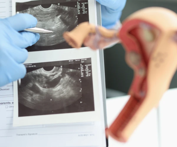 Gynaecological ultrasound scan with pelvic measurements, supporting women’s health assessment, diagnostic imaging and clinical decision-making.