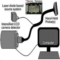 schematic of the handheld optical imaging system 
