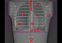 Lung Imaging: Photon-Counting Detectors & Thermoluminescence Dosimetry