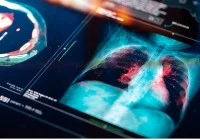 Measuring MRI Biomarker Repeatability for Better Radiotherapy Outcomes