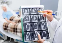 Comparing Definitions of Small Airway Dysfunction: the HRCT-based study