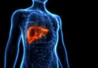 Assessing Intratumoural Fat in Hepatocellular Carcinoma with MRI