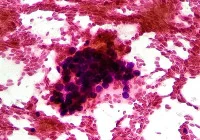 Advancing Hepatocellular Carcinoma Prognostics Through Radiogenomics  