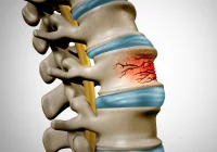 The Role of Deep Learning in Detecting Vertebral Compression Fractures