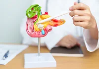 CT Radiomics and Clinical Data for Predicting Acute Pancreatitis