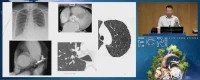 How to Improve Chest CT Reports