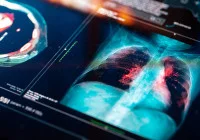 Medical MRI scan revealing detailed imaging for accurate diagnosis and treatment.