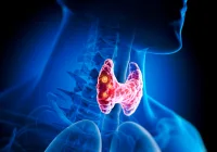 3D illustration of thyroid gland with nodules – endocrine health, thyroid cancer or hormone disorder diagnosis 