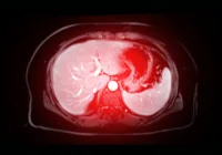 Abdominal MRI scan highlighting liver in red, used for diagnosing liver disease or organ abnormalities. 