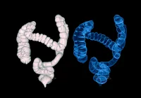 3D CT colonography images showing detailed anatomical structure of the human large intestine