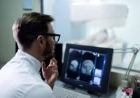 Radiologist reviewing brain MRI images at the scanner console to illustrate standardised diffusion protocols. 