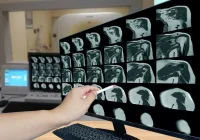Radiologist reviewing MRI shoulder scans on a computer monitor, representing musculoskeletal imaging and diagnostic analysis. 