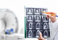 Lung CT scan images being reviewed by a clinician with a CT scanner visible in the background.